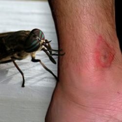 Insectes dangereux : ici vous pouvez savoir si vous êtes allergique aux piqûres d’insectes